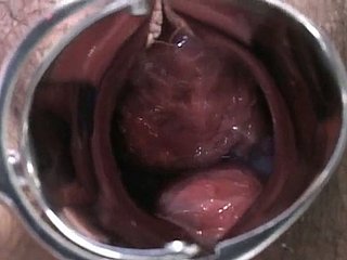 Senhora grávida japonês é examinado e suga lollicock effect médico